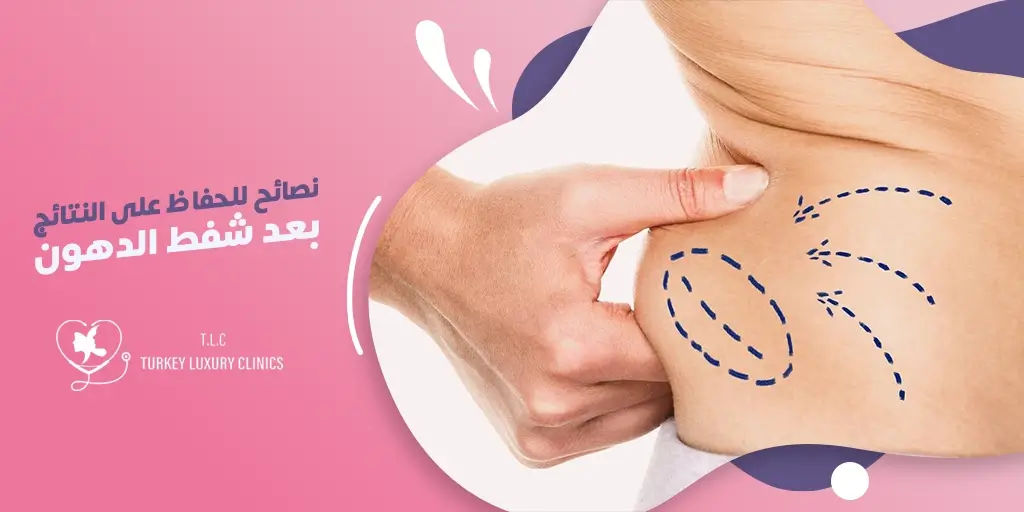نصائح للحفاظ على النتائج بعد شفط الدهون