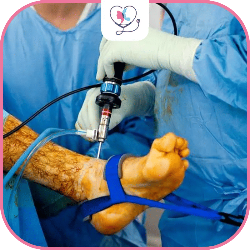 تكلفة تنظير مفصل الكاحل في تركيا