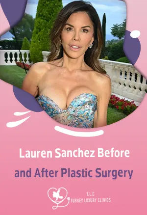 Lauren Sanchez Vorher-Nachher: Plastische Chirurgiefeatured image