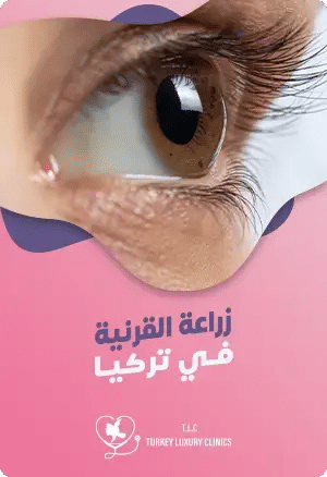 زراعة القرنية في تركيا - كيف تكون؟ وماهي التكلفة؟featured image