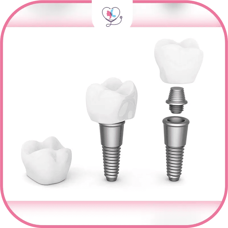 What Are the Best Dental Implant Brands in 2026?