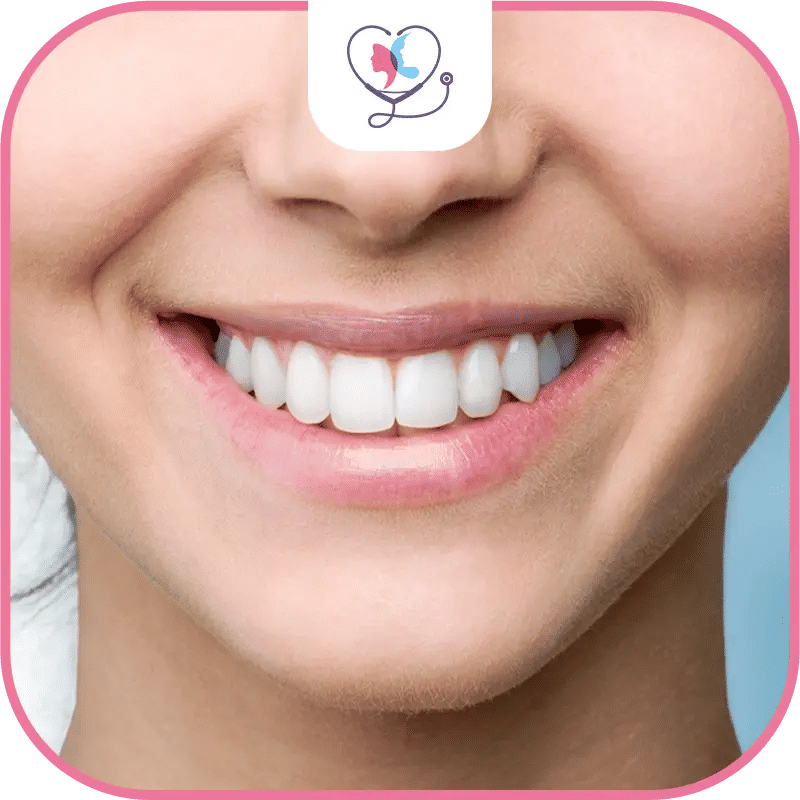 Avantages des couronnes sur implant dentaire