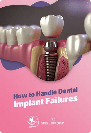 How to Handle Dental Implant Failures