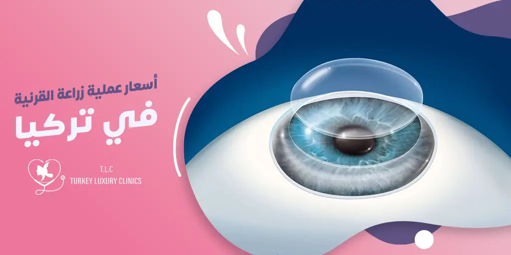 تكلفة زراعة القرنية في تركيا