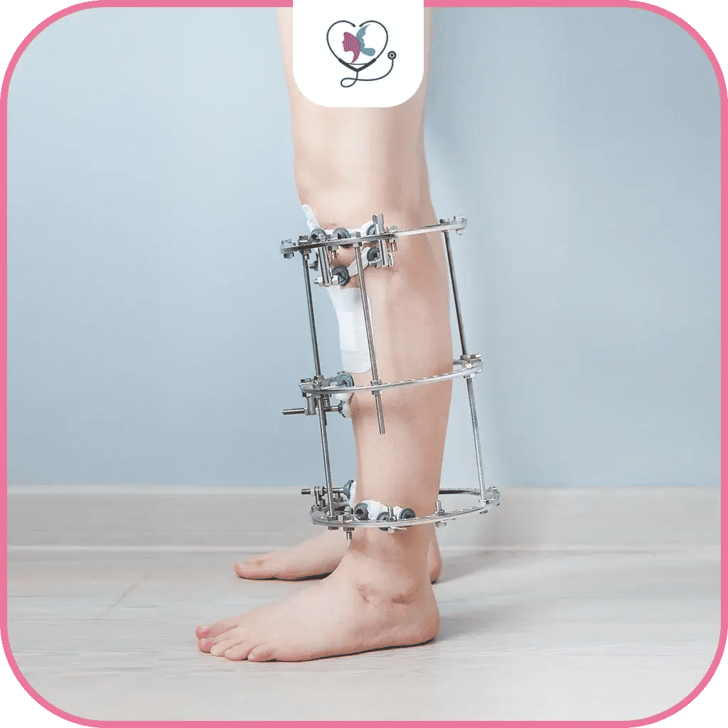 ما بعد عملية زيادة الطول في تركيا