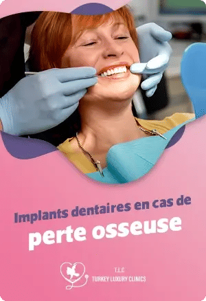 Implants dentaires en cas de perte osseuse