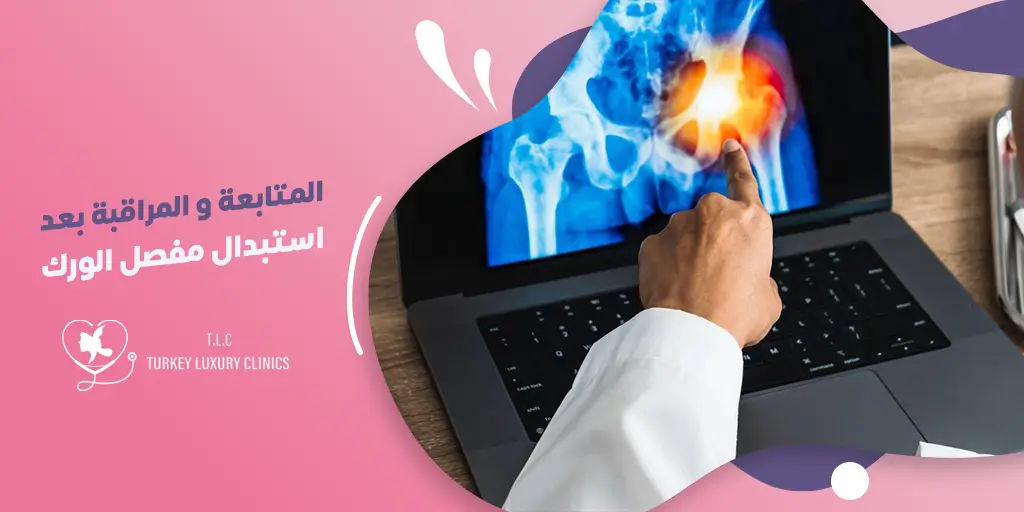 المتابعة والمراقبة بعد استبدال مفصل الورك: الأهمية والبقاء يقظاً