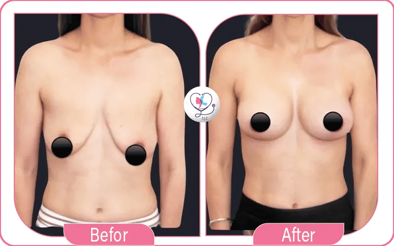 ثانياً: بعد العملية: فترة التعافي