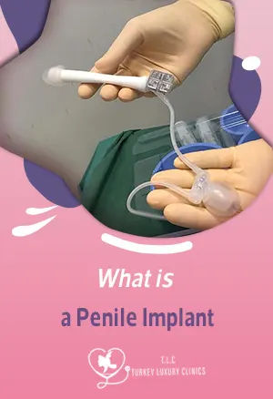 What is a Penile Implant? 2026 Types, Cost, Recovery & Results