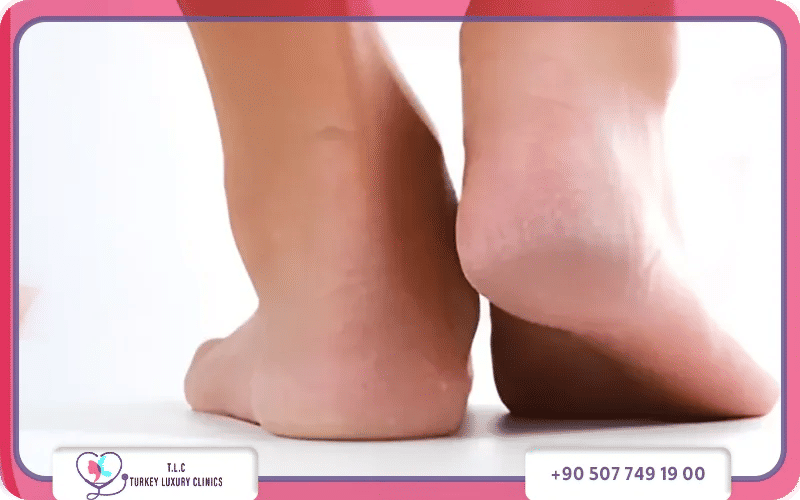 ما هو علاج اختلاف طول الساقين؟