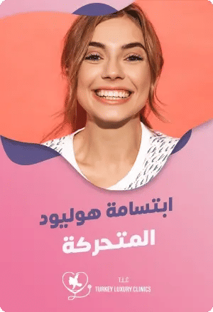 ماهي ابتسامة هوليود المتحركة؟featured image
