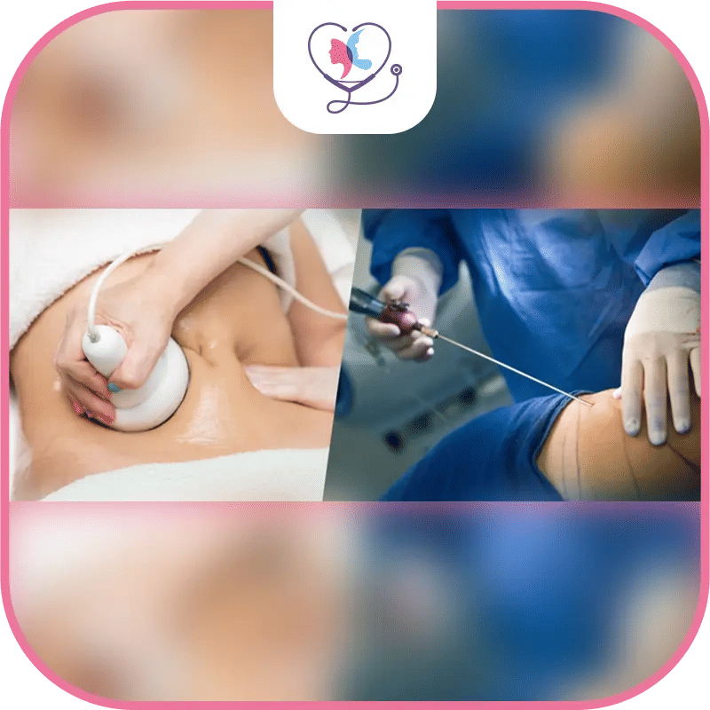 Avantages et inconvénients de chaque technique