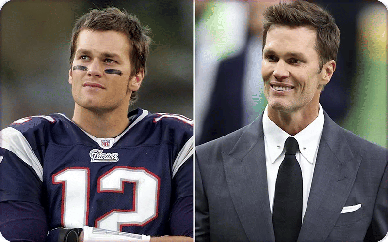 Tom Brady Plastic Surgery Over the Years