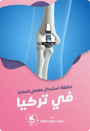 تكلفة استبدال مفصل الساعد في تركياfeatured image
