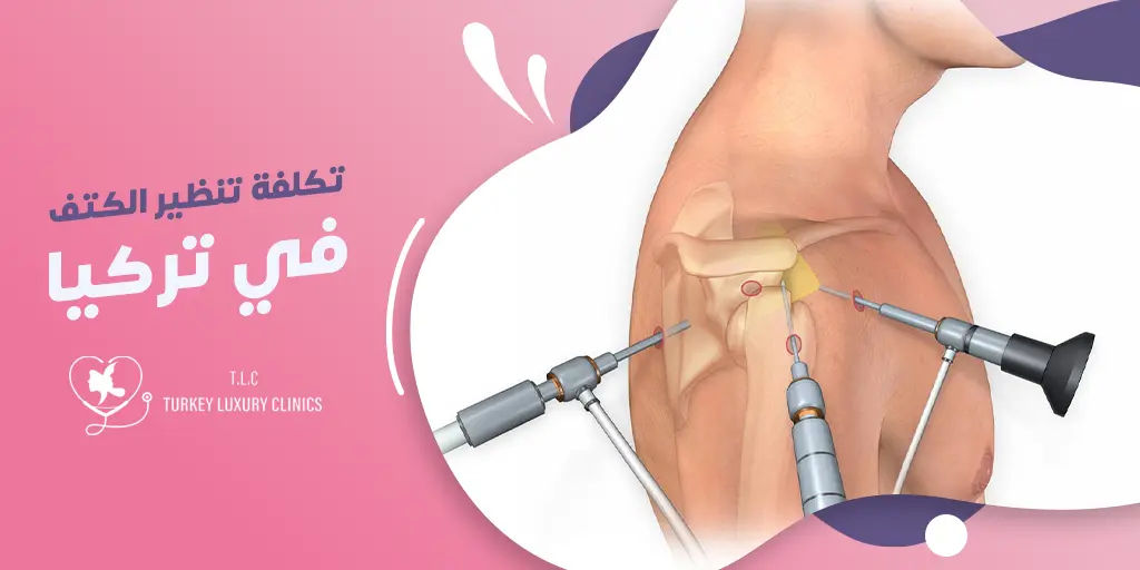 تكلفة عملية تنظير الكتف في تركيا
