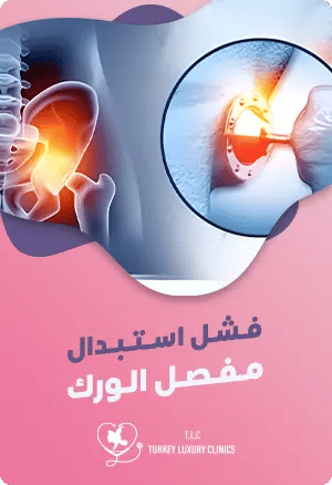 فشل استبدال مفصل الورك featured image