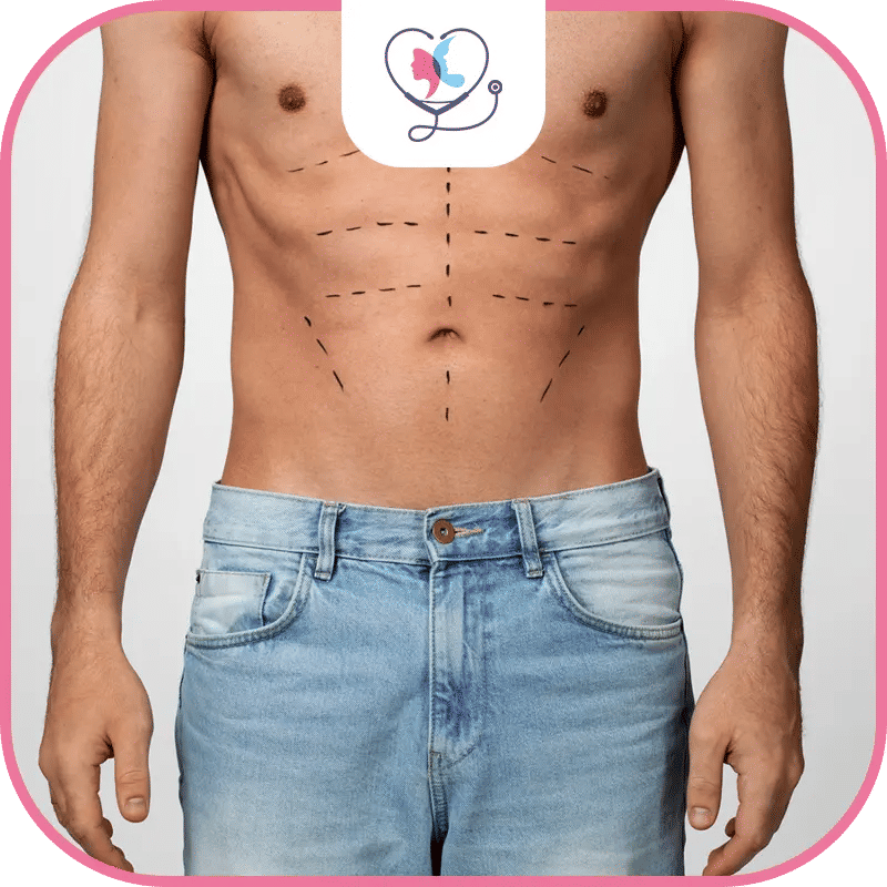 المرشحون لعملية نحت عضلات البطن