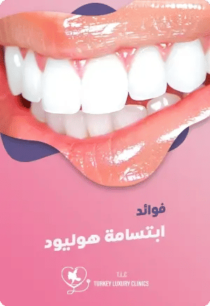 فوائد ابتسامة هوليودfeatured image