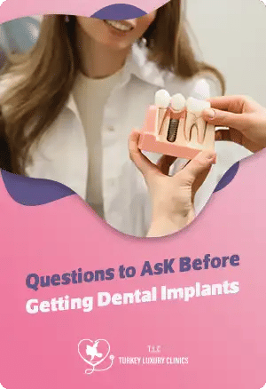 Questions to Ask Before Getting Dental Implants