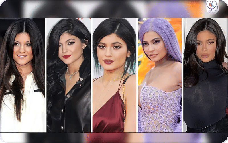 Transformation de Kylie Jenner au fil des années
