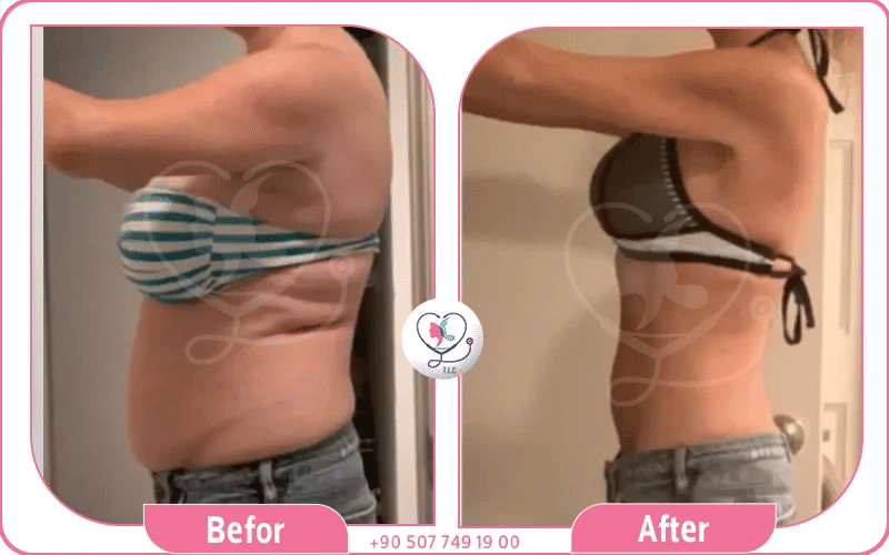 تجارب ابر اوزمبك للتنحيف وقصص نجاح قبل وبعد الاستخدام