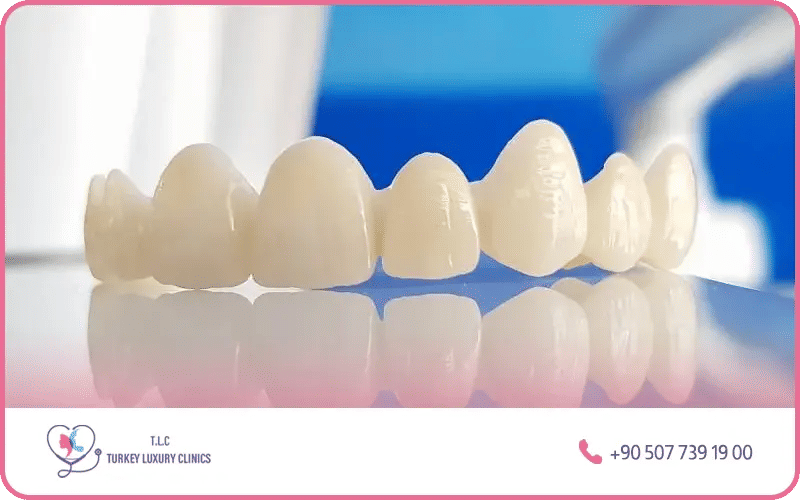 What are 20 and 24 zirconium crowns – full-mouth dental restoration with zirconia crowns Turkey comprehensive packages