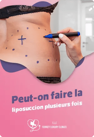 Peut-on faire la liposuccion plusieurs fois ?