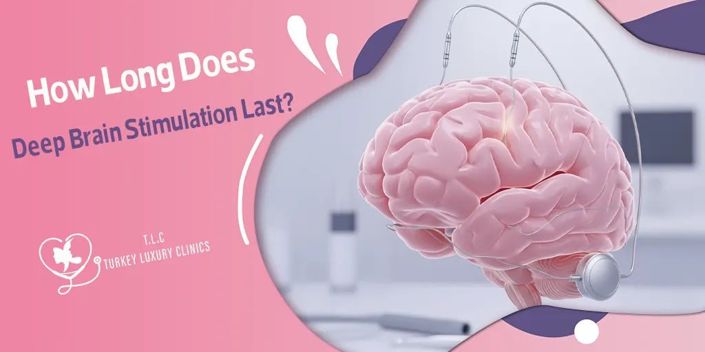 How Long Does Deep Brain Stimulation Last?