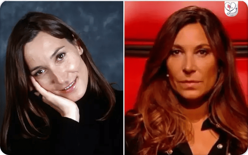 Zazie chirurgie esthétique des lèvres