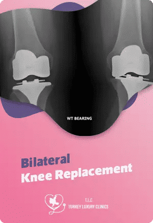 Bilaterale Knieprothese: Kosten, Genesung & Recovery