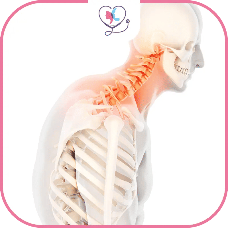 الحداب Kyphosis