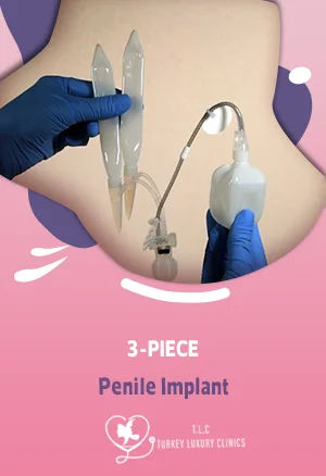3-Piece Penile Implant: Surgery, Best Cost, & Reviews 2026 