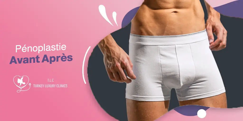 Pénoplastie Avant Après : Résultats Réels et Photos
