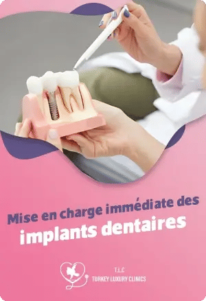 Mise en charge immédiate des implants dentaires