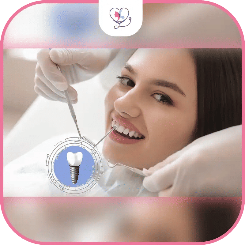 Titanium Dental Implant vs Zirconia