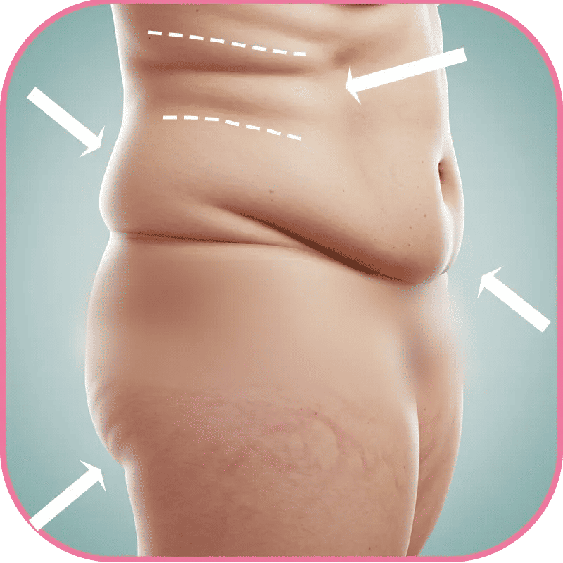 Gastric Sleeve Before and After Pictures Skin