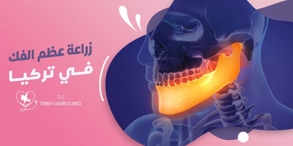 زراعة عظم الفك في تركيا