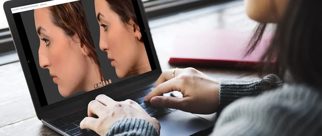 Pour quels patients la modélisation 3D est-elle recommandée ?