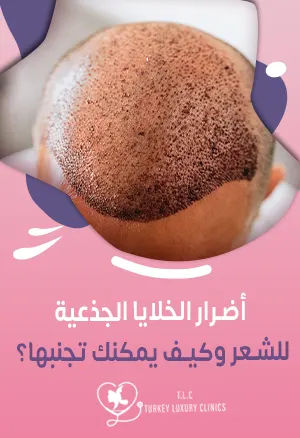 أضرار الخلايا الجذعية للشعر: ماهي؟ مع نصائح للوقاية منها