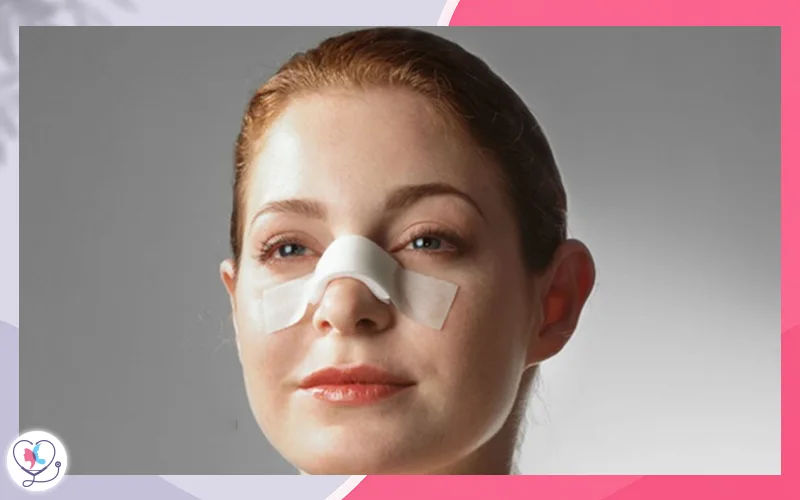 ماذا بعد عملية تجميل الأنف؟