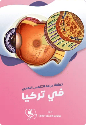 تكلفة جراحة التنكس البقعي في تركياfeatured image