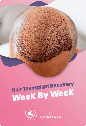 Hair Transplant Recovery Week By Week