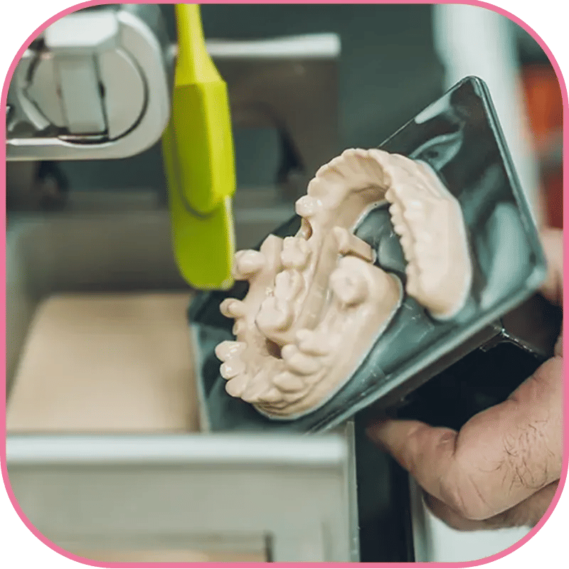 3D Printed Dental Implants Image