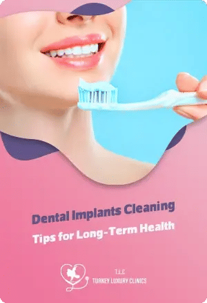 Dental Implants Cleaning: Tips for Long-Term Healthfeatured image