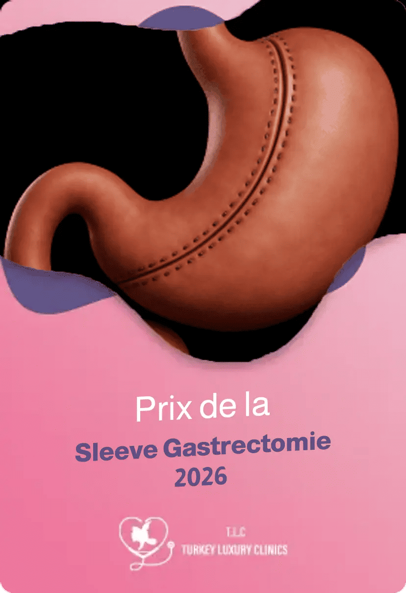 Prix de la Sleeve Gastrectomie 2026 : Turquie vs Belgiquefeatured image