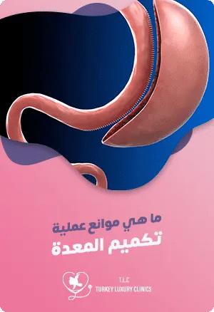ما هي موانع عملية تكميم المعدة؟featured image