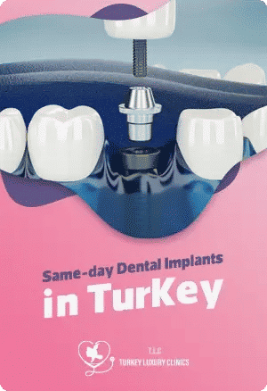 Zahnimplantate an einem Tag in der Türkei – Schnell & Preiswert