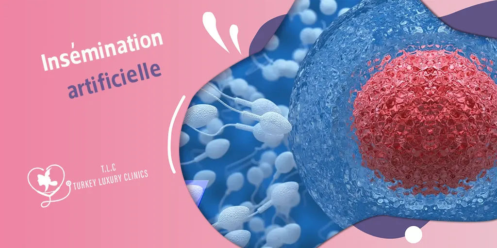 Insémination artificielle au premier essai : tout savoir pour maximiser vos chances