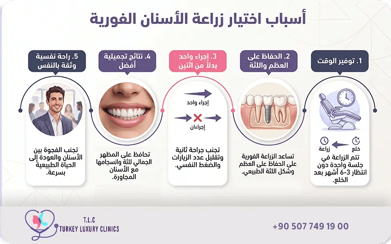 لماذا اخترت زراعة الأسنان الفورية