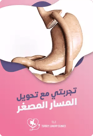 تجربتي مع عملية تحويل المسار المصغرfeatured image
